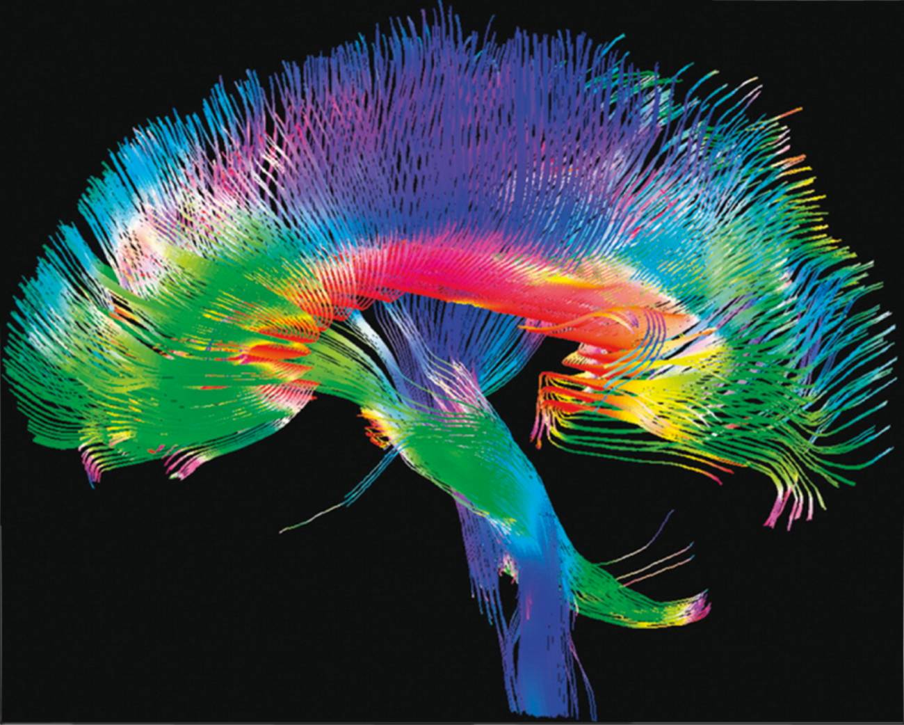Detallan cómo la arquitectura cerebral controla la actividad neuronal