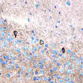 Expresión inmunohistoquímica de perfusión fija, tejido cerebral de ratón congelado sondeado con anticuerpo policlonal anti-leptina/OB de ratón, teñido con kit HRP-DAB y contrateñido con hematoxilina.