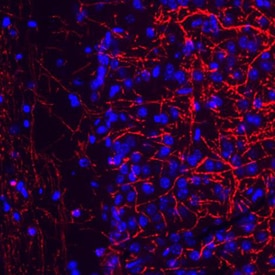 Expresión inmunohistoquímica de secciones cerebrales de ratón sondeadas con anticuerpos monoclonales anti-MBP de ratón, teñidos con anticuerpos secundarios anti-ratón en rojo y núcleos contrateñidos en azul.