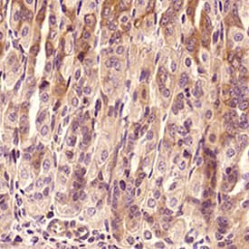 Expresión inmunohistoquímica del anticuerpo policlonal anti-TNF-alfa de conejo en el intestino de ratón incrustado en parafina fija en formalina, teñido con el kit HRP-DAB y contramantado con hematoxilina.