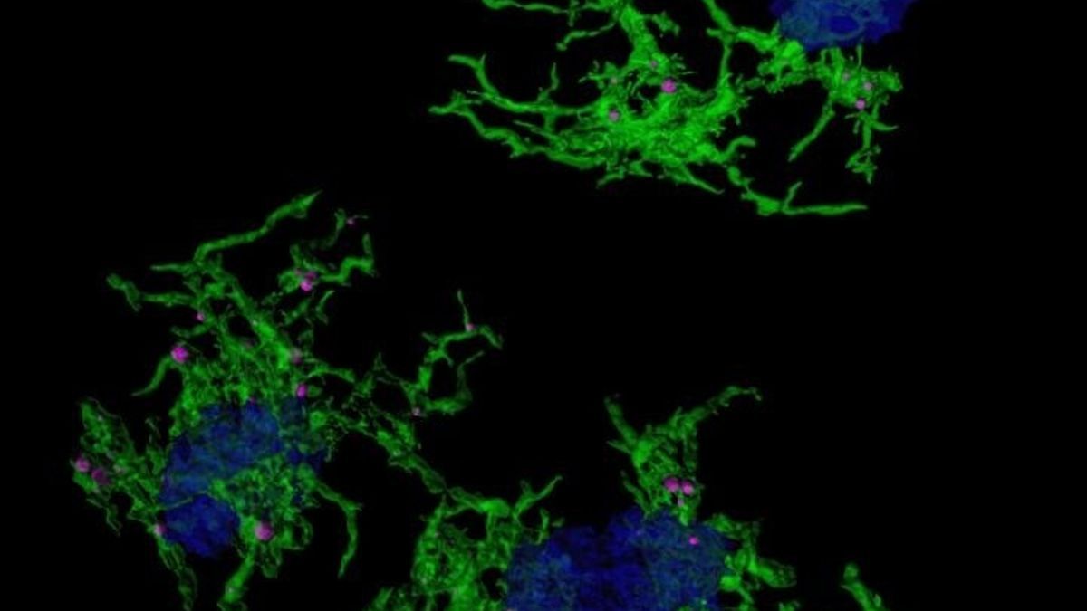 Imagen microscópica confocal microglia verde envuelve placas amiloide azul