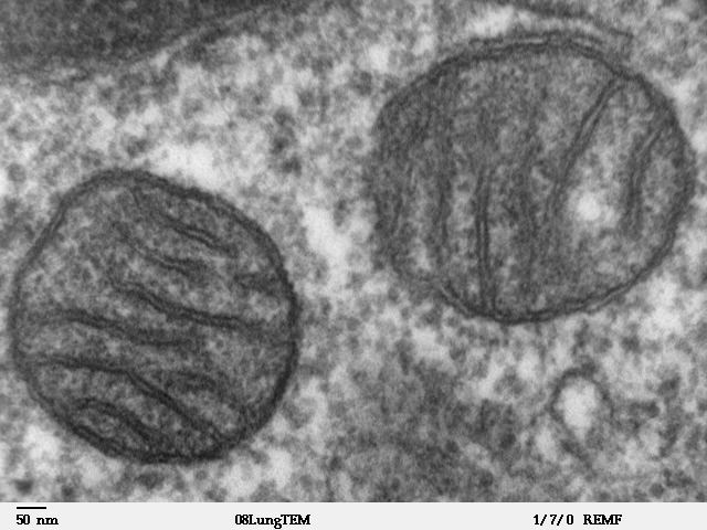 Imagen obtenida por microscopía electrónica del tejido pulmonar de un mamífero, donde se visualizan dos mitocondrias.