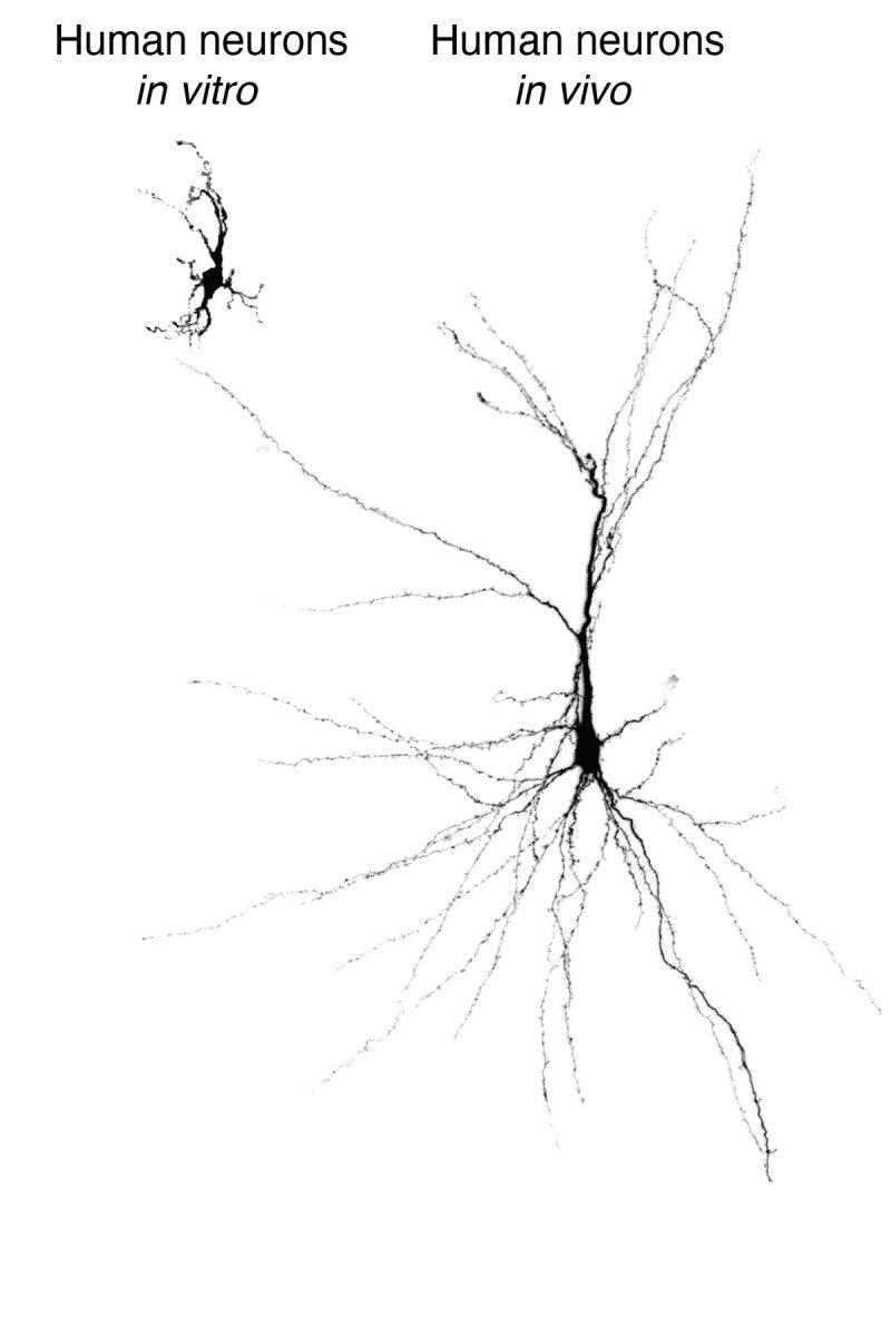 Neuronas humanas derivadas de células madre y mantenidas in vitro o trasplantadas (in vivo) en el córtex del cerebro de rata. Foto: UNIVERSIDAD DE STANFORD