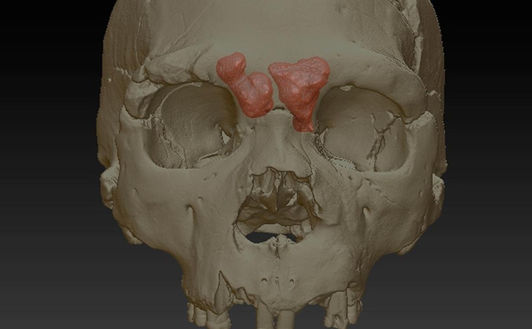 Reconstrucción virtual del Cráneo 5 de la Sima de los Huesos con los senos frontales en opaco. Vista superior