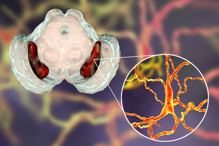 Sustancia Negra Del Cerebro Medio Y Sus Neuronas Dopaminérgicas, Ilustración 3D. La Sustancia Negra Regula El Movimiento Y La Recompensa, Su Degeneración Es Un Paso Clave En El Desarrollo De La Enfermedad