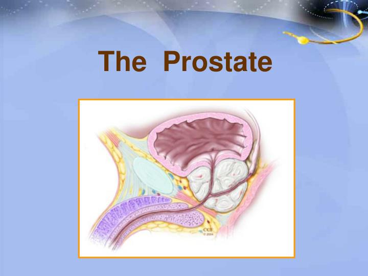 Extander és prostatitis