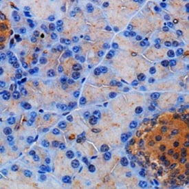 Tinción inmunohistoquímica del páncreas de ratón con anti-somatostatina policlonal de conejo Receptor 2/SSRT2 y contramanteada con DAB y hematoxilina.