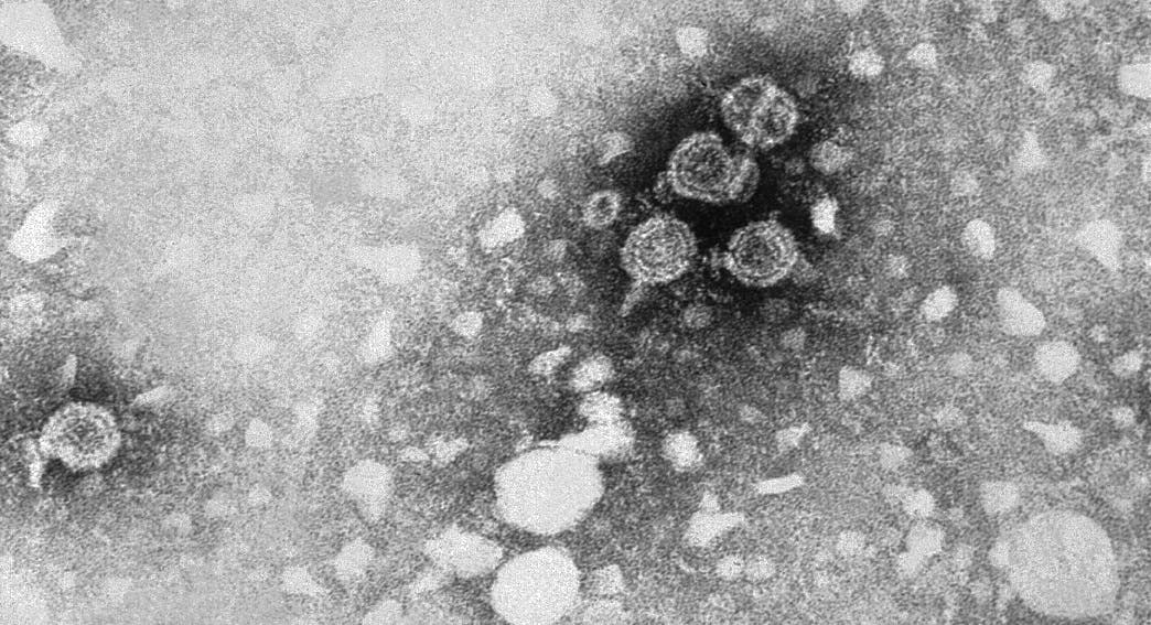 Virus ADN Bicatenario