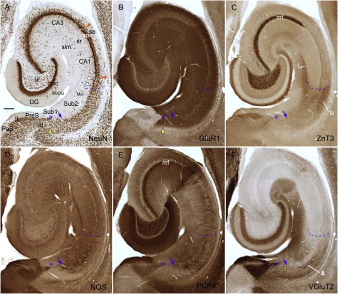 EL DIENCEFALO. ESTRUCTURA